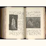 P01A149