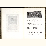 P04A155